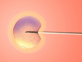 Can You Still Have IVF with Only One Ovary? Can You Still Have IVF with Only One Ovary?