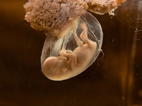 What Happens If Your Embryo Transfer Is Delayed? What Happens If Your Embryo Transfer Is Delayed?