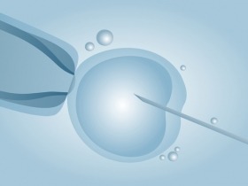 How Long Should You Wait Between IVF Cycles? 
